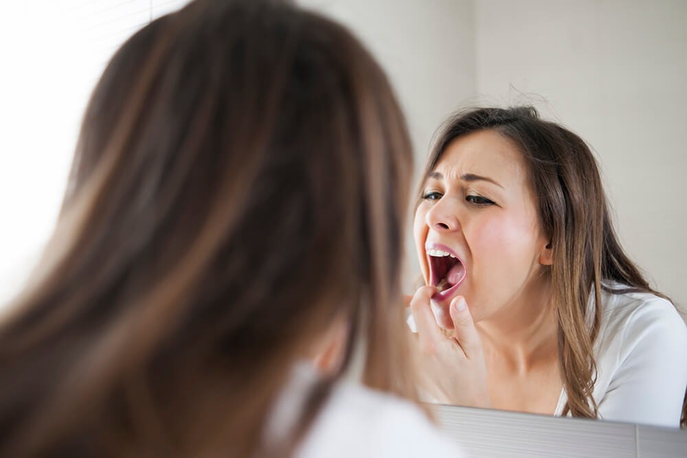 15 Tips For Successfully Managing & Living with Chronic Oral Lichen Planus