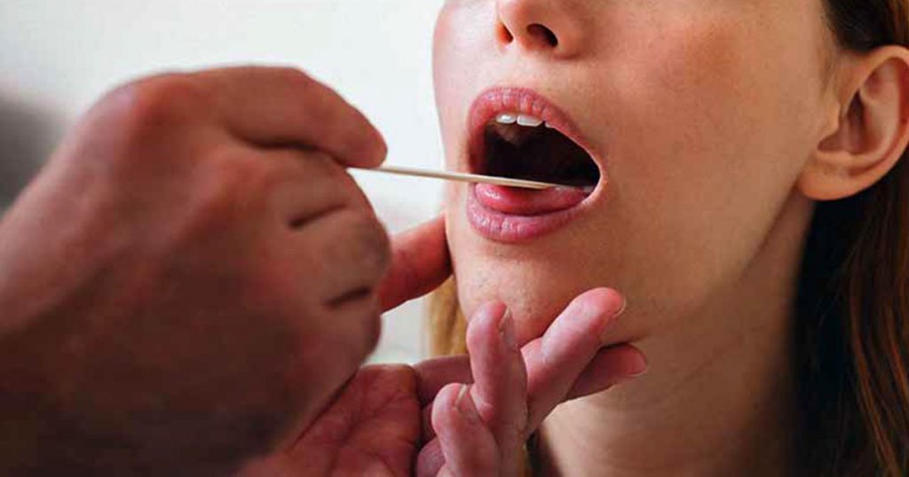 Woman getting treatment for Oral Lichen Planus