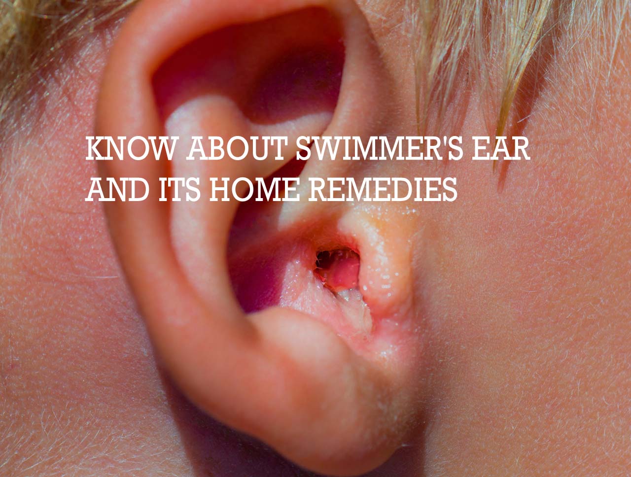 All that you should know about Swimmer's ear and its home remedies