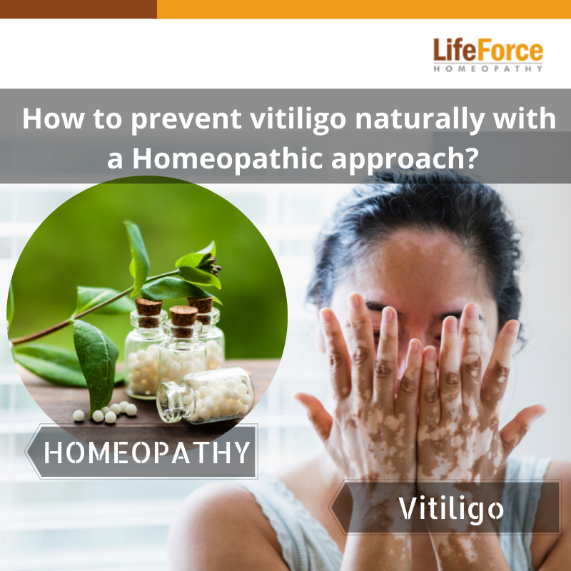 prevent vitiligo with a homeopathy approach?