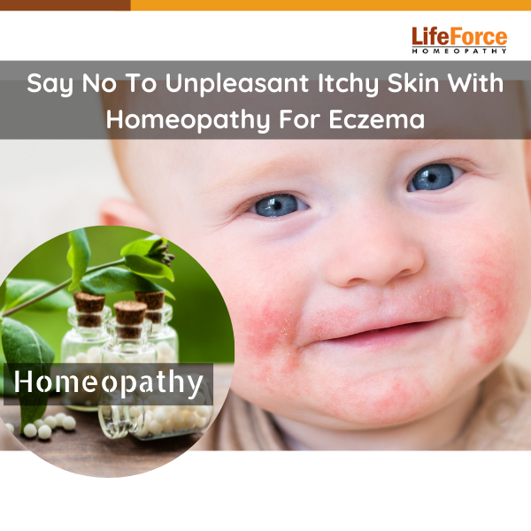 Say No To Unpleasant Itchy Skin With Homeopathy For Eczema