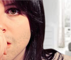 Homeopathy For unwanted hair growth (Hirsutism)