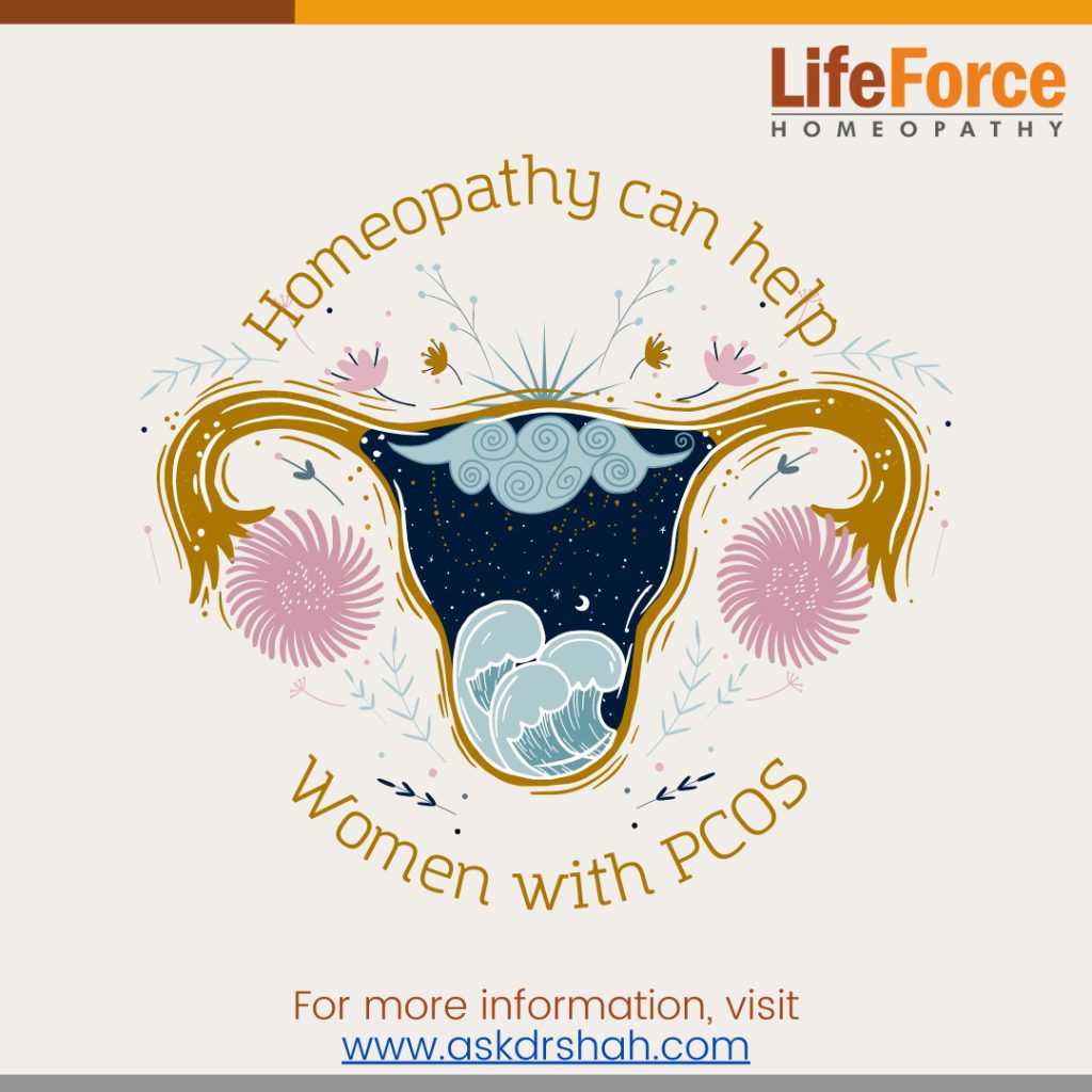How homeopathy Helps Women with PCOD? And Causes and Symptoms of PCOS/PCOD