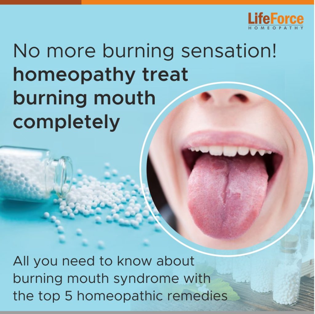 IS HOMEOPATHY A SOLUTION FOR CONSTANT BURNING IN THE MOUTH!!!
