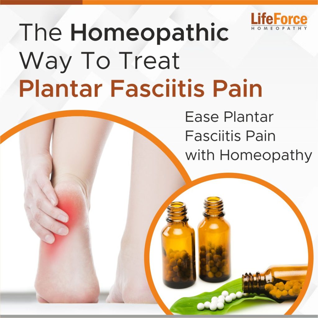 Ease Plantar Fasciitis Pain With Homeopathy