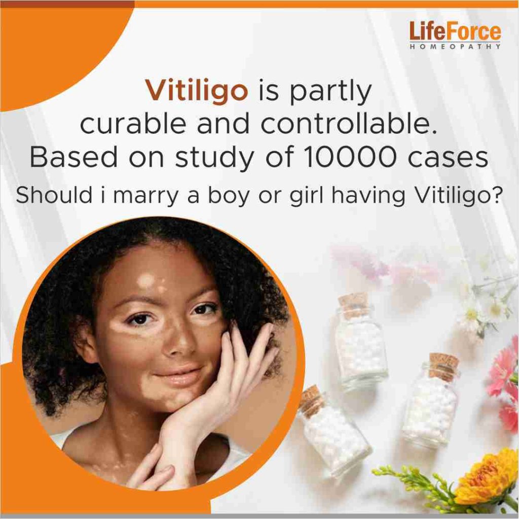 Should I marry a boy or a girl having Vitiligo?