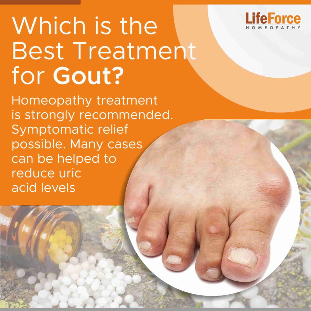 Which is the Best Treatment for Gout?