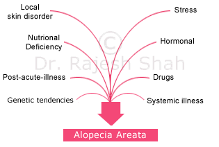 Causes of Alopecia Areata
