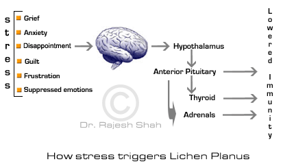 How Stress Triggers Lichen Planus