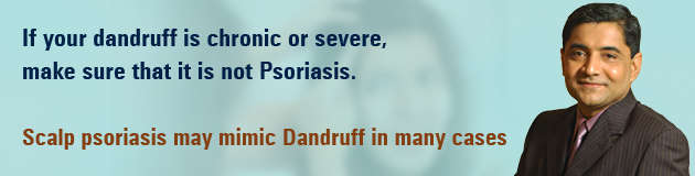 If your dandruff is chronic or severe make sure it is not Psoriasis