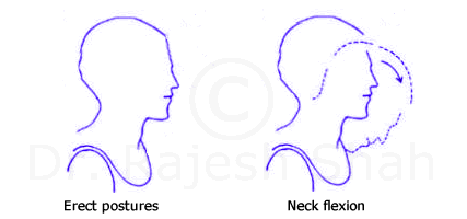 Flexiblity exercise neck flexion for cervical spondylosis