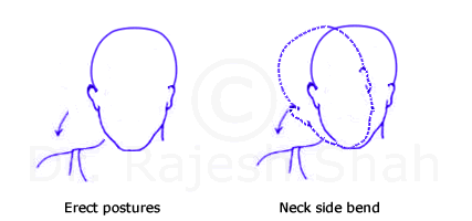 Flexiblity exercise neck side bend for cervical spondylosis