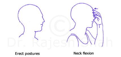 Neck flexion exercise for cervical spondylitis