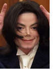 Michael Jackson Suffered with Vitiligo