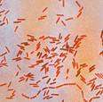 Gram-negative bacilli Salmonella typhi