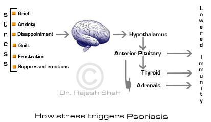 Stress Triggers Psoriasis