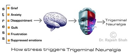 how stress triggers trigeminal neuralgia