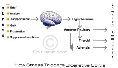 How stress triggers ulcerative colitis