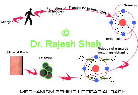 Urticaria rash mechanism