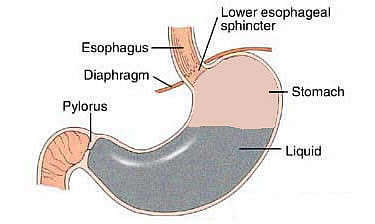 Functioning of abdomen in Gastro esophageal reflux disease