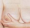 Description: Breast examination test