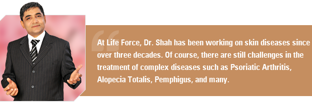 At Life Force, Dr Shah has been working on skin diseases since over three decades. Of course, there are still challenges in the treatment of complex diseases such as Psoriatic Arthritis, Alopecia Totalis, Pemphigus, and many.